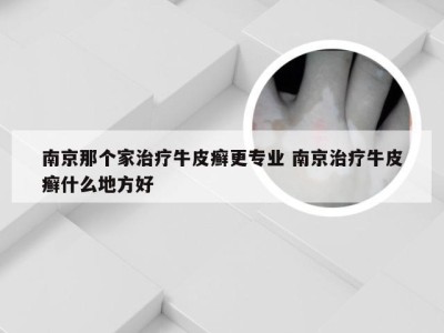 南京那个家治疗牛皮癣更专业 南京治疗牛皮癣什么地方好