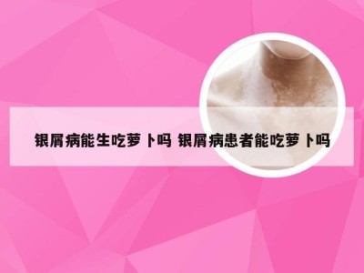 银屑病能生吃萝卜吗 银屑病患者能吃萝卜吗