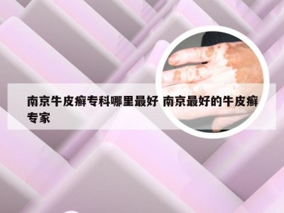 南京牛皮癣专科哪里最好 南京最好的牛皮癣专家