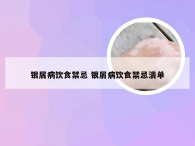 银屑病饮食禁忌 银屑病饮食禁忌清单