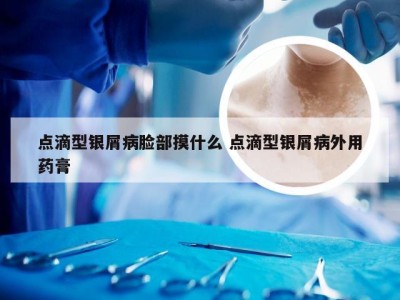 点滴型银屑病脸部摸什么 点滴型银屑病外用药膏