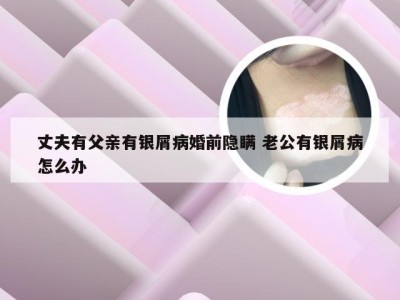 丈夫有父亲有银屑病婚前隐瞒 老公有银屑病怎么办
