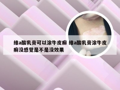 维a酸乳膏可以涂牛皮癣 维a酸乳膏涂牛皮癣没感觉是不是没效果