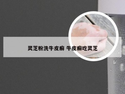 灵芝粉洗牛皮癣 牛皮癣吃灵芝