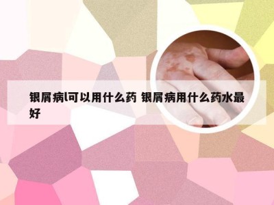 银屑病l可以用什么药 银屑病用什么药水最好