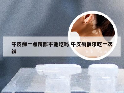 牛皮癣一点辣都不能吃吗 牛皮癣偶尔吃一次辣