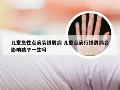 儿童急性点滴装银屑病 儿童点滴行银屑病会影响孩子一生吗
