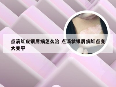点滴红皮银屑病怎么治 点滴状银屑病红点变大变平