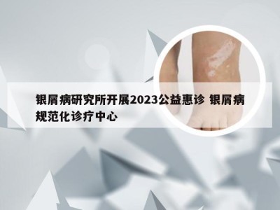 银屑病研究所开展2023公益惠诊 银屑病规范化诊疗中心