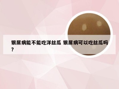 银屑病能不能吃洋丝瓜 银屑病可以吃丝瓜吗?