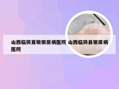 山西临猗夏敏银屑病医院 山西临猗县银屑病医院