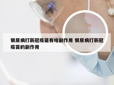 银屑病打新冠疫苗有啥副作用 银屑病打新冠疫苗的副作用