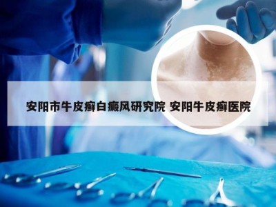 安阳市牛皮癣白癜风研究院 安阳牛皮癣医院