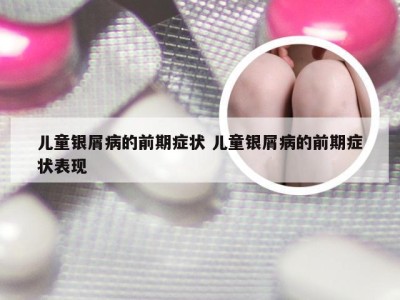 儿童银屑病的前期症状 儿童银屑病的前期症状表现