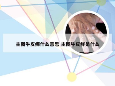 主图牛皮癣什么意思 主图牛皮鲜是什么