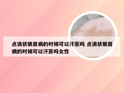 点滴状银屑病的时候可以汗蒸吗 点滴状银屑病的时候可以汗蒸吗女性