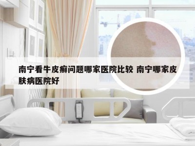 南宁看牛皮癣问题哪家医院比较 南宁哪家皮肤病医院好