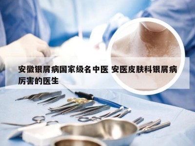 安徽银屑病国家级名中医 安医皮肤科银屑病厉害的医生