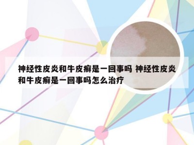 神经性皮炎和牛皮癣是一回事吗 神经性皮炎和牛皮癣是一回事吗怎么治疗
