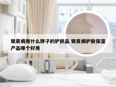 银屑病用什么牌子的护肤品 银屑病护肤保湿产品哪个好用