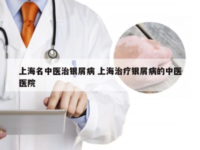 上海名中医治银屑病 上海治疗银屑病的中医医院