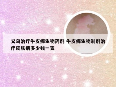义乌治疗牛皮癣生物药剂 牛皮癣生物制剂治疗皮肤病多少钱一支