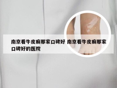 南京看牛皮癣那家口碑好 南京看牛皮癣那家口碑好的医院