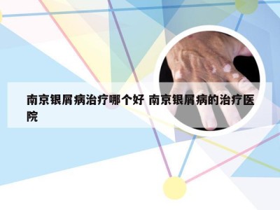南京银屑病治疗哪个好 南京银屑病的治疗医院
