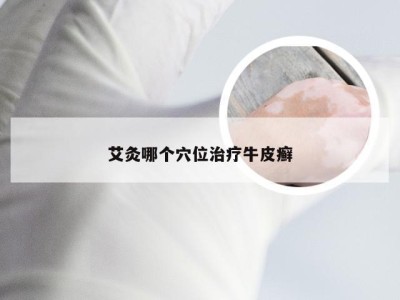 艾灸哪个穴位治疗牛皮癣