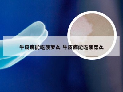 牛皮癣能吃菠萝么 牛皮癣能吃菠菜么