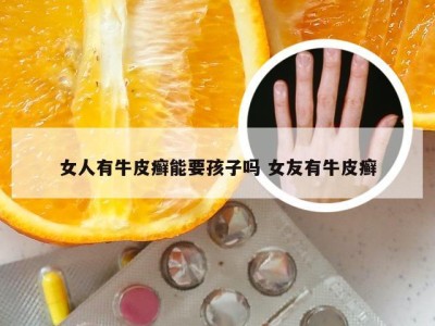 女人有牛皮癣能要孩子吗 女友有牛皮癣