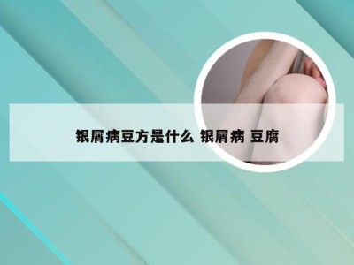 银屑病豆方是什么 银屑病 豆腐