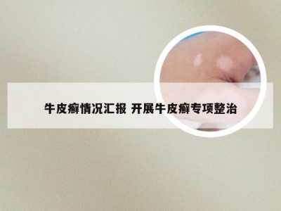 牛皮癣情况汇报 开展牛皮癣专项整治
