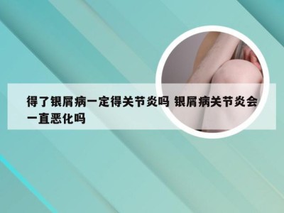 得了银屑病一定得关节炎吗 银屑病关节炎会一直恶化吗