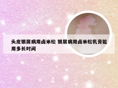 头皮银屑病用卤米松 银屑病用卤米松乳膏能用多长时间