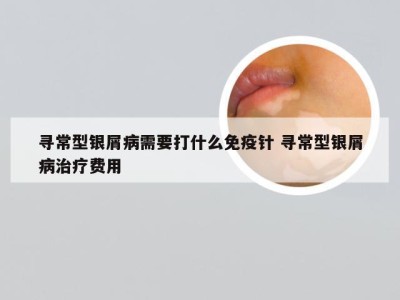 寻常型银屑病需要打什么免疫针 寻常型银屑病治疗费用