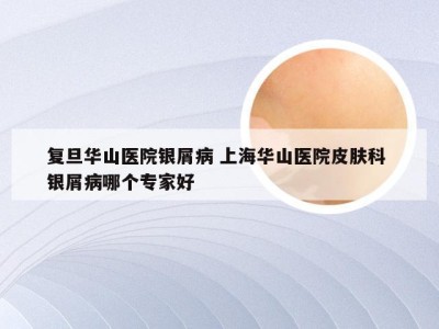 复旦华山医院银屑病 上海华山医院皮肤科 银屑病哪个专家好