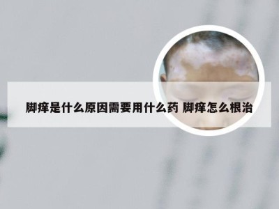 脚痒是什么原因需要用什么药 脚痒怎么根治