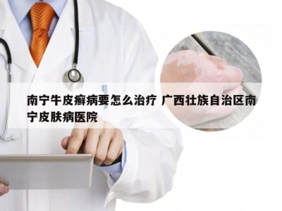 南宁牛皮癣病要怎么治疗 广西壮族自治区南宁皮肤病医院
