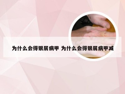 为什么会得银屑病甲 为什么会得银屑病甲减