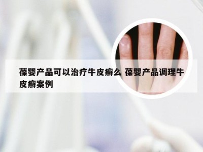 葆婴产品可以治疗牛皮癣么 葆婴产品调理牛皮癣案例