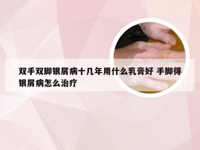 双手双脚银屑病十几年用什么乳膏好 手脚得银屑病怎么治疗