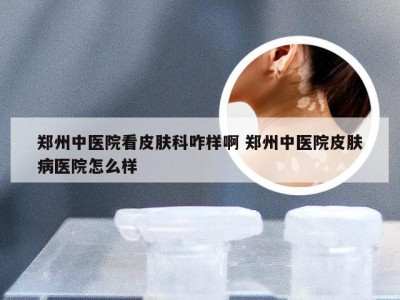 郑州中医院看皮肤科咋样啊 郑州中医院皮肤病医院怎么样