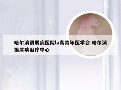 哈尔滨银屑病医院la高青年医学会 哈尔滨银屑病治疗中心