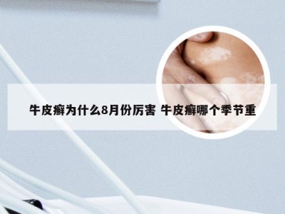牛皮癣为什么8月份厉害 牛皮癣哪个季节重