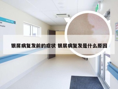 银屑病复发前的症状 银屑病复发是什么原因