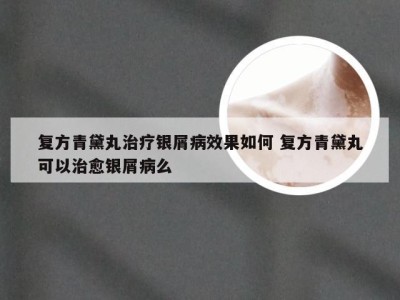 复方青黛丸治疗银屑病效果如何 复方青黛丸可以治愈银屑病么