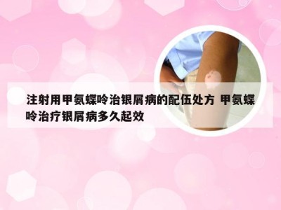 注射用甲氨蝶呤治银屑病的配伍处方 甲氨蝶呤治疗银屑病多久起效