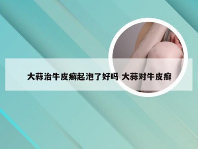 大蒜治牛皮癣起泡了好吗 大蒜对牛皮癣