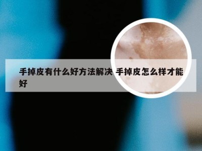 手掉皮有什么好方法解决 手掉皮怎么样才能好